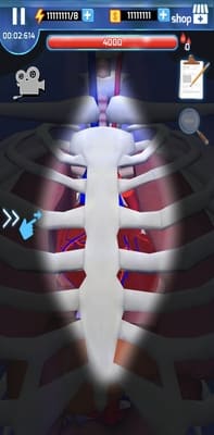 Surgery Master screenshots